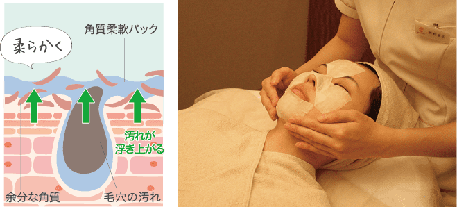 軟化パックで汚れを軟化